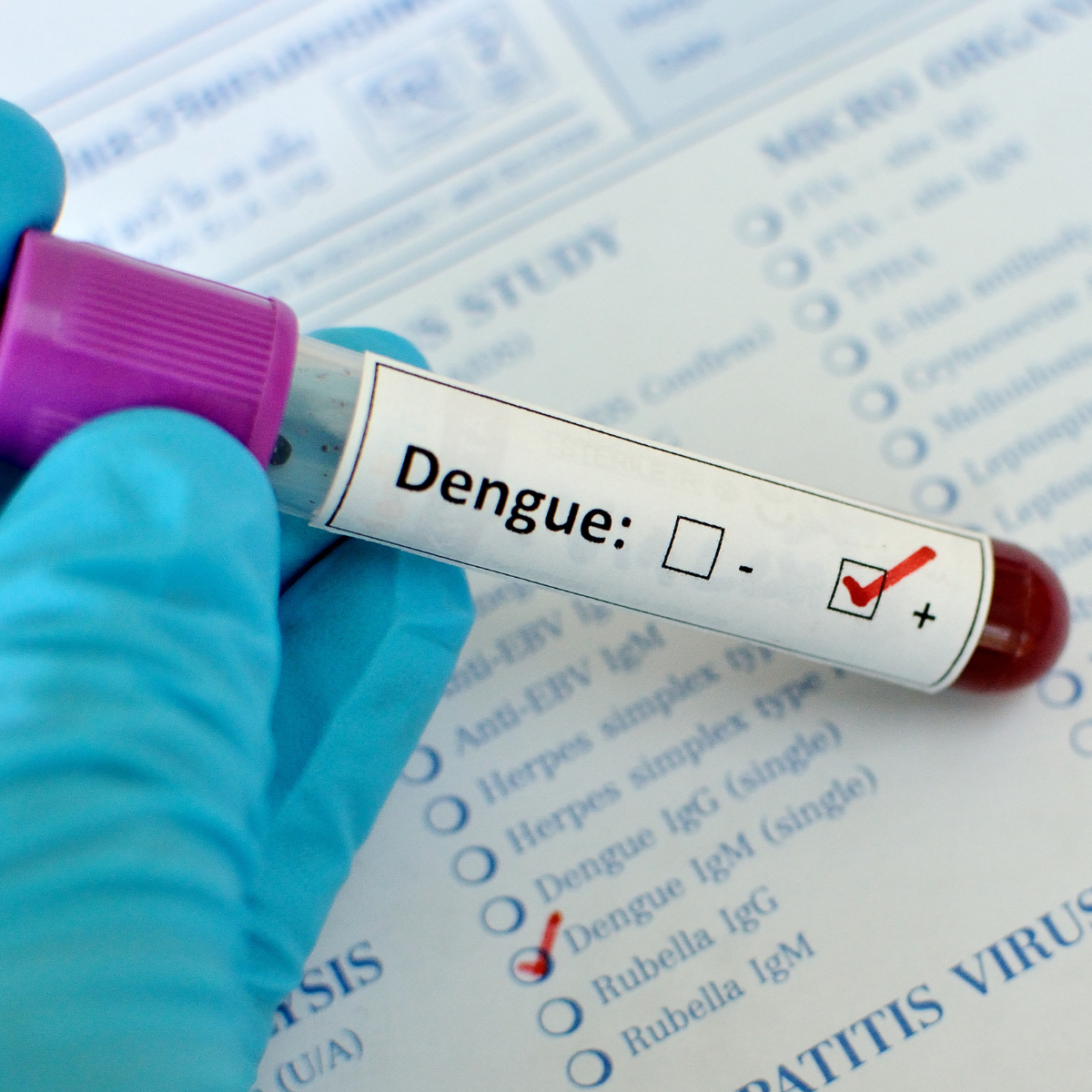 Dengue